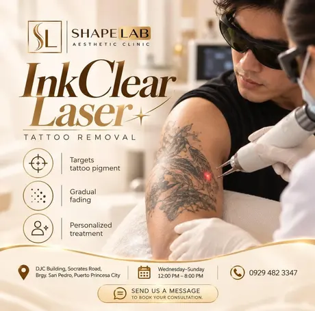 ShapeLab InkClear tattoo removal post (ShapeLab’s own post artwork)