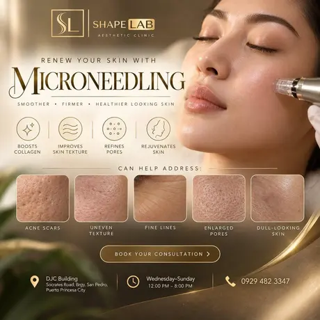 ShapeLab microneedling post (ShapeLab’s own post artwork)