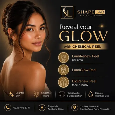ShapeLab chemical peel post (ShapeLab’s own post artwork)