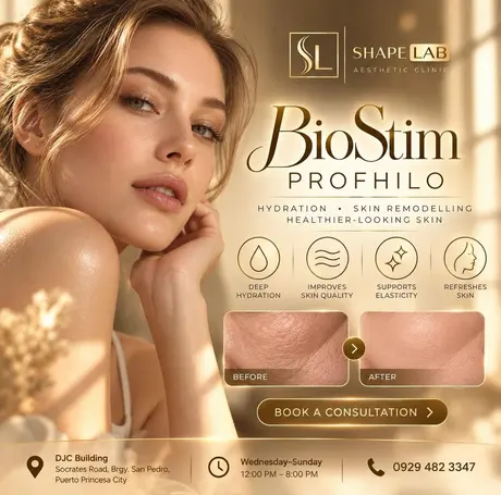 ShapeLab BioStim Profhilo post (ShapeLab’s own post artwork)