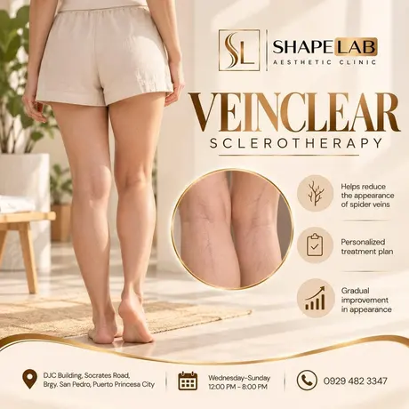 ShapeLab VeinClear sclerotherapy post (ShapeLab’s own post artwork)