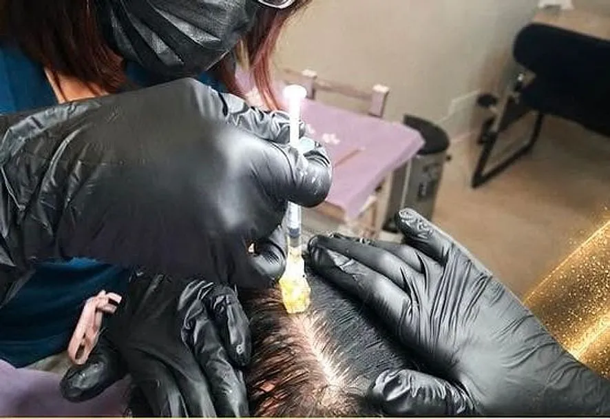 A gloved clinician performing a scalp treatment